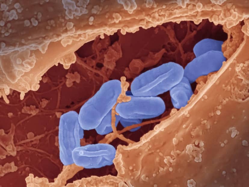 Powrót zabójcy sprzed tysiącleci. Naukowcy biją na alarm: antybiotyki nie działają