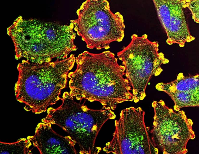 Zaprojektować guza, by go pokonać. Biodruk 3D zmienia onkologię