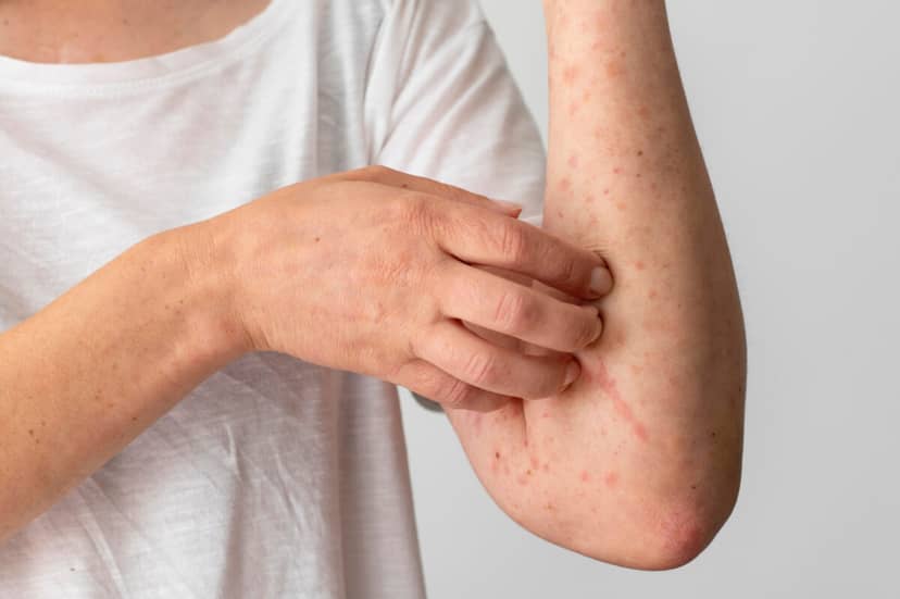 Pacjenci z AZS odetchną z ulgą? Nowa terapia robi to, co wcześniej się nie udawało
