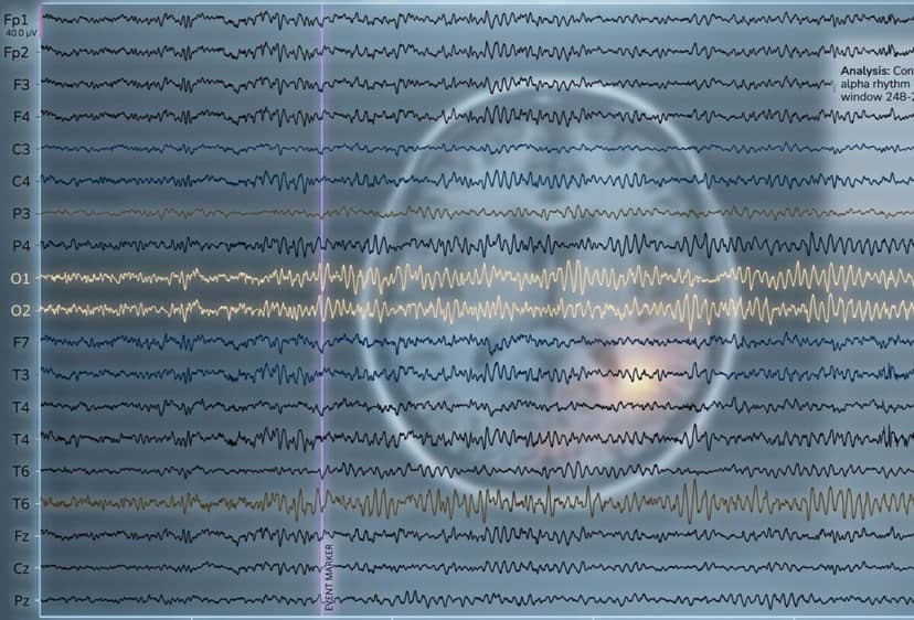 Rodzaj przyjmowanego leku psychiatrycznego można wyczytać z zapisu EEG