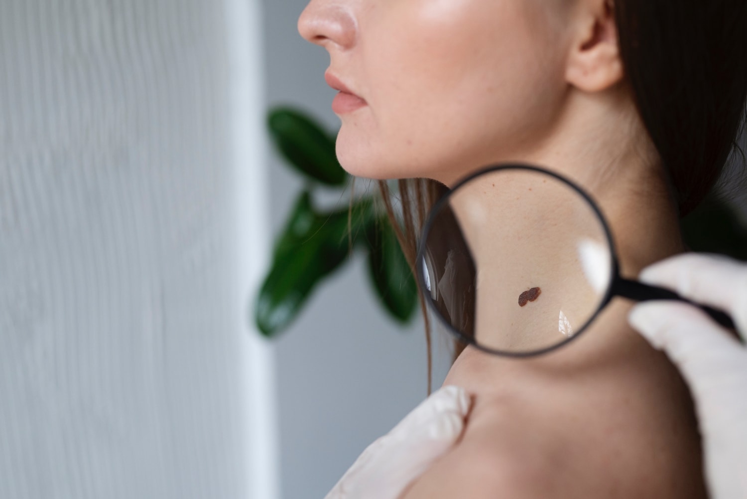 Dermatolog oglądający znamię &#8211; zdjęcie poglądowe /Fot. Freepik

