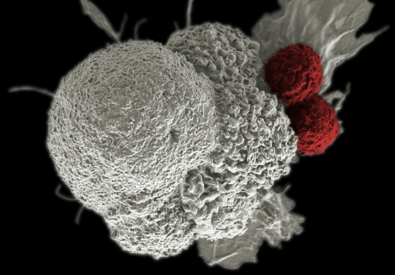 Immunoterapia nowotworowa. Na zdjęciu widać komórkę raka (biała) atakowaną przez dwa limcofyty T (czerwone), które niszczą komórki nowotworowe /Fot. NIH, Unsplash
