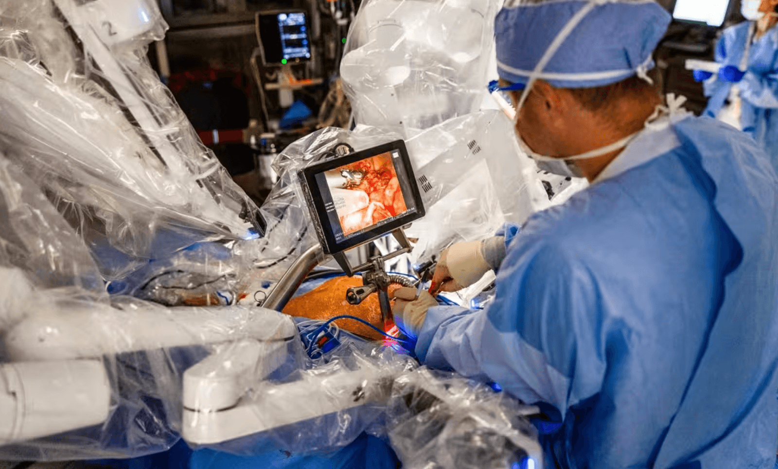 Chirurdzy podczas operacji /Fot. Cleveland Clinic
