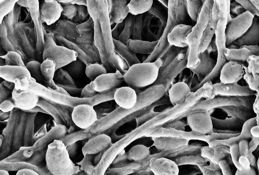 Grzyb Candida albicans &#8211; zdjęcie poglądowe /Fot. Wikimedia Commons

